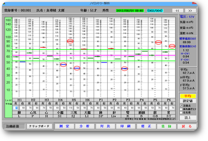 ノイロメトリー解析ソフト画面